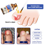 Bee Venom for Nail Fungus: A Complete Solution to Nail Fungus & Growth (BUY 1 GET 1 FREE)
