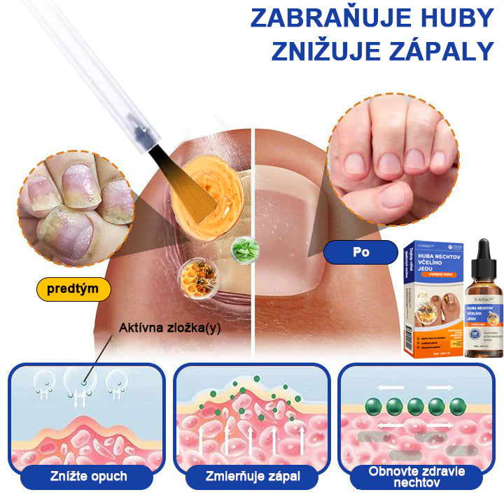 Bee Venom for Nail Fungus: A Complete Solution to Nail Fungus & Growth (BUY 1 GET 1 FREE)