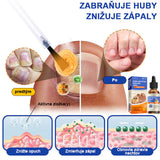 Bee Venom for Nail Fungus: A Complete Solution to Nail Fungus & Growth (BUY 1 GET 1 FREE)