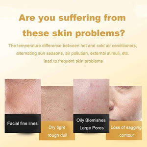 ✨Last Day Promotion🎁Gold Foil Peel-Off Mask [ BUY 1 GET 1 FREE ]