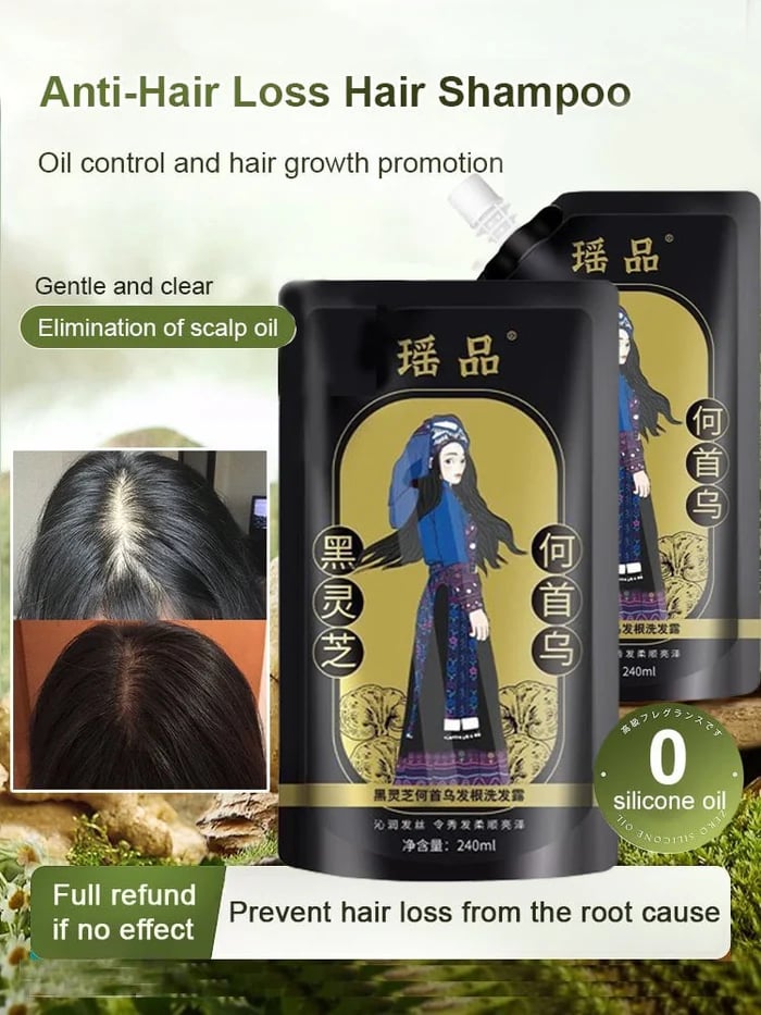✨🎁Hot Sale Ginger Plant Extract Anti-Hair Loss Hair Shampoo( Buy 1 Get 1 Free)✨🎁
