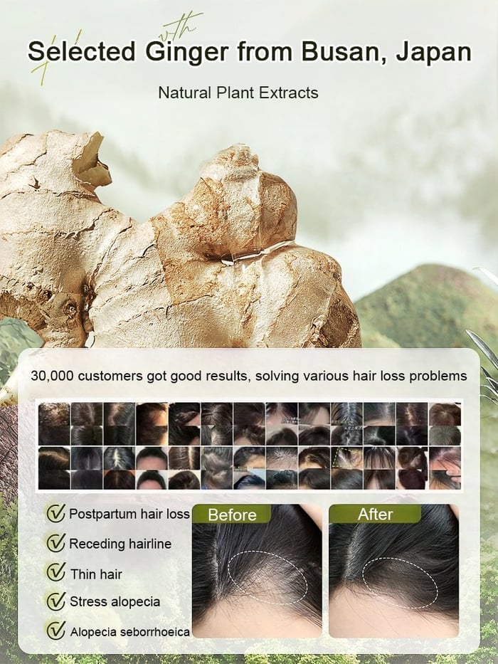 ✨🎁Hot Sale Ginger Plant Extract Anti-Hair Loss Hair Shampoo( Buy 1 Get 1 Free)✨🎁